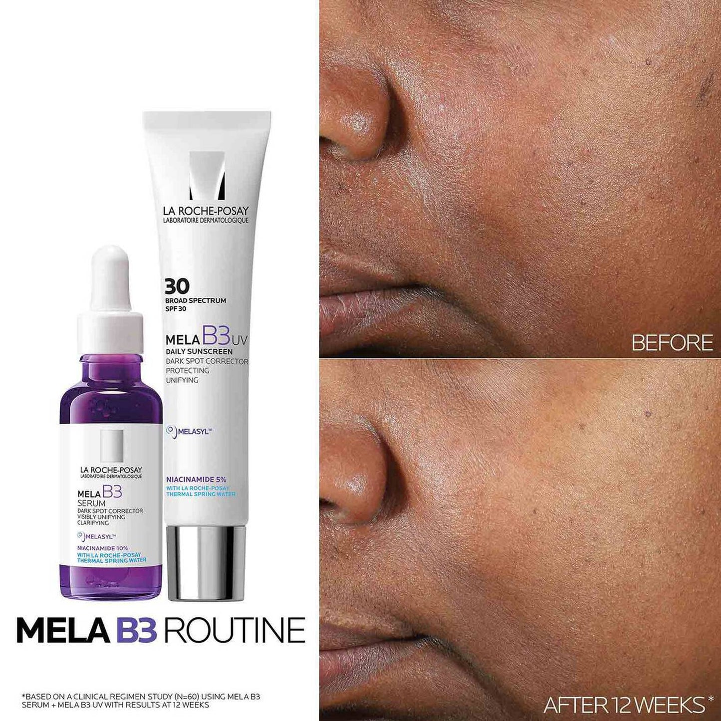 mela-b3-dark-spot-serum-and-mela-b3-uv-daily-moisturizer-with-spf-30-h1 3-Mela-B3-routine_1500X1500.jpg