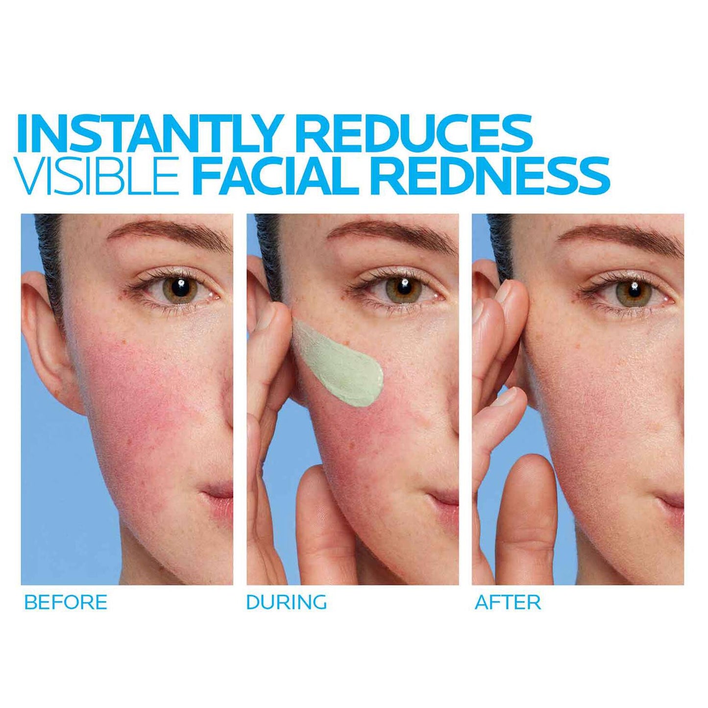 toleriane-rosaliac-ar-face-cream-for-visible-redness-y6 8_Toleriane_Rosaliac-AR-before-after.jpg