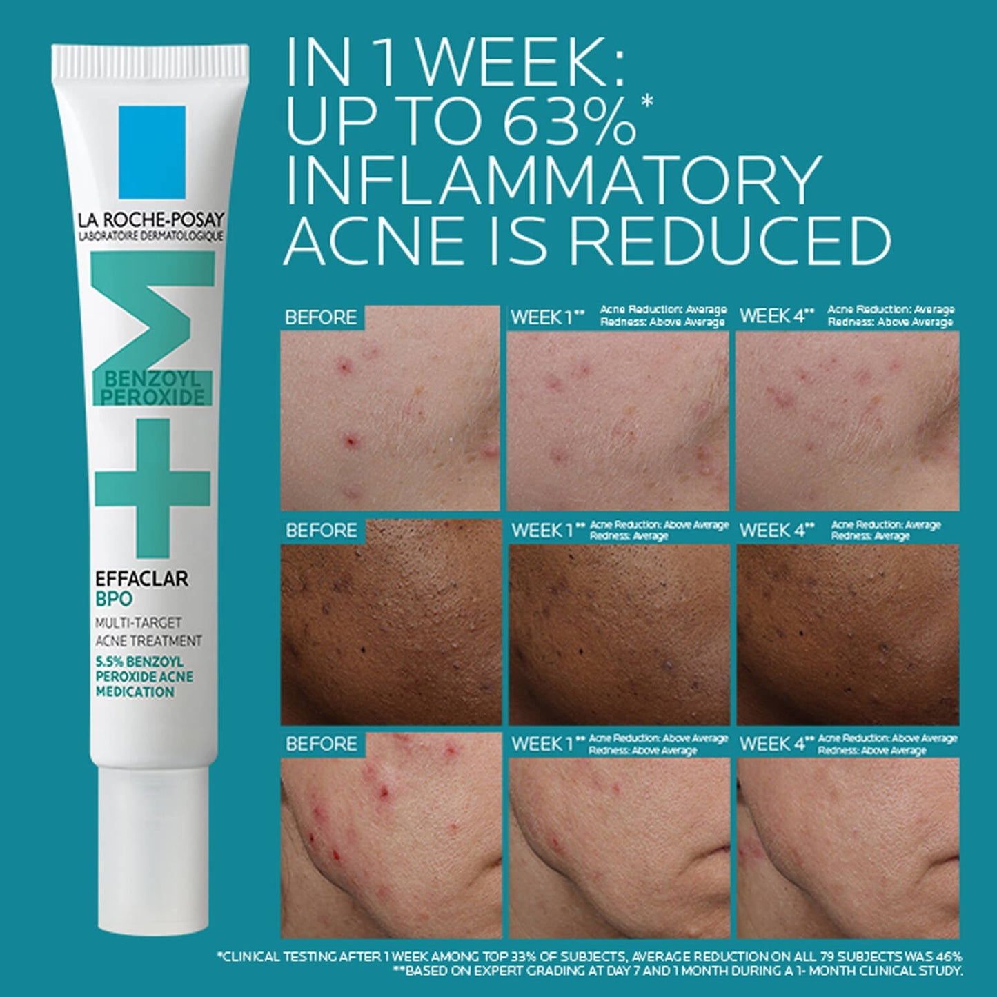 effaclar-bpo-multi-target-acne-treatment-with-5-5-benzoyl-peroxide-n9 EffaclarBPO-ClinicalBA-ATF-1500x1500-2.jpg
