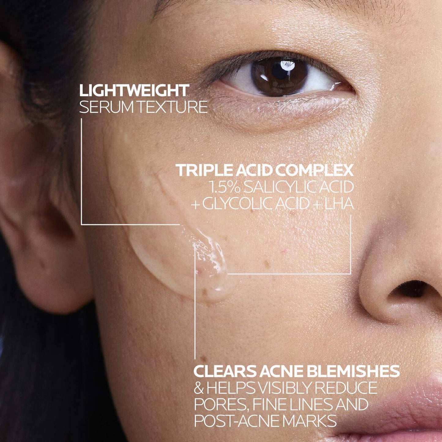 effaclar-salicylic-acid-acne-treatment-serum-e8 LaRochePosay-Product-Effaclar-Effaclar-Serum-30ml-3337875722827-Texture-REV.jpg