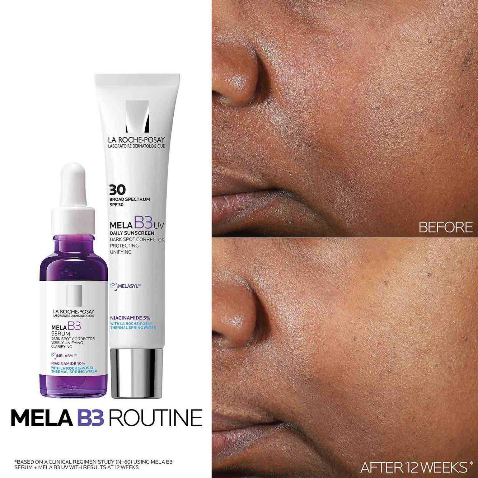 mela-b3-dark-spot-serum-with-melasyltm-niacinamide-i5 Mela-B3-routine_1500X1500.jpg